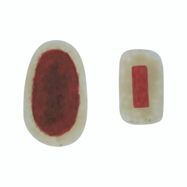 Anatomy Lab SP Moulage for TCM - Erysipelas module