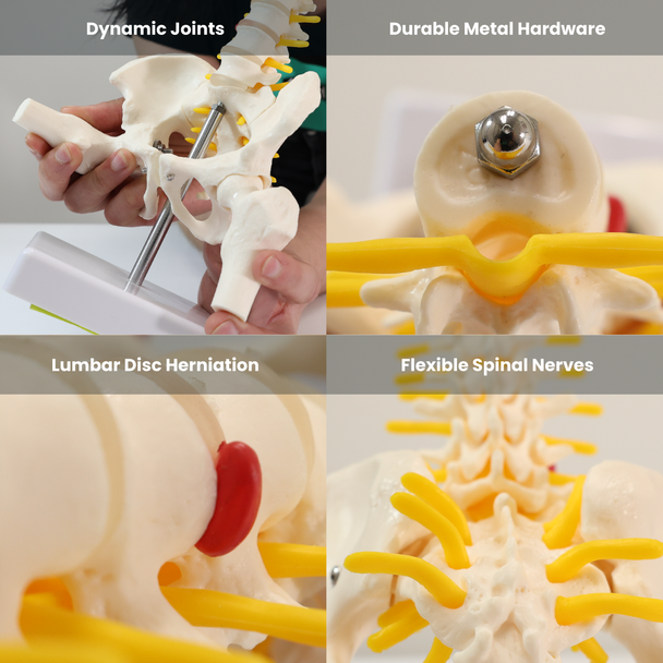 Axis Scientific Pelvis with Lumbar Vertebrae, Half Size