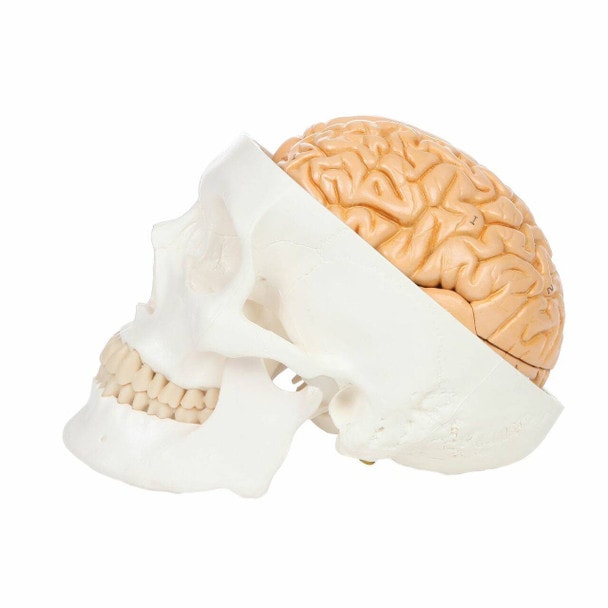 Axis Scientific Life-Size 3-Part Human Skull Model with brain exposed.