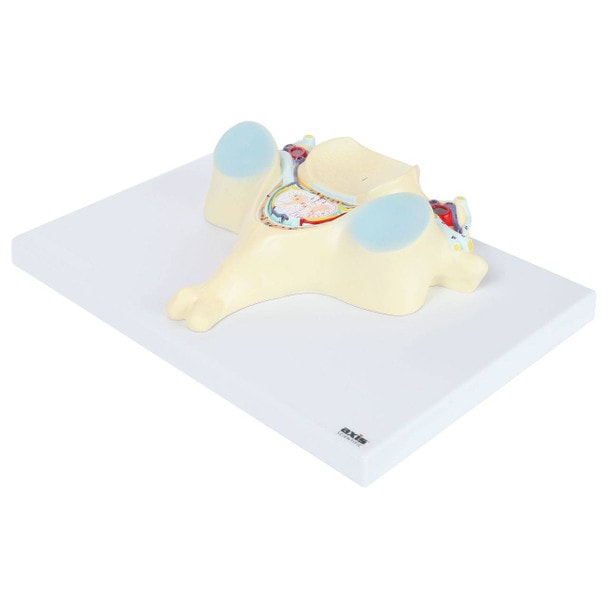 Axis Scientific 5th Cervical Vertebra