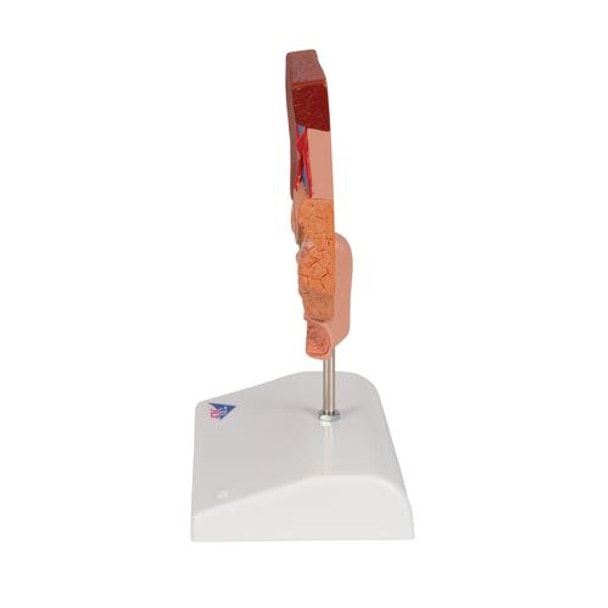 Gallstone Anatomy Model