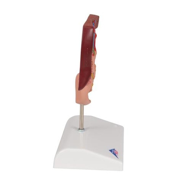 Gallstone Anatomy Model