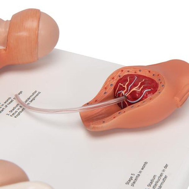 5-State Human Birth Process Anatomy Model