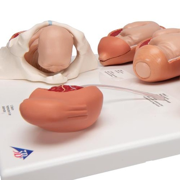 5-State Human Birth Process Anatomy Model
