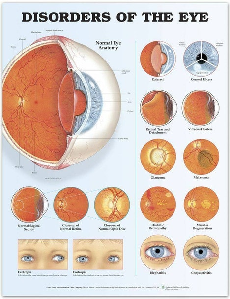 Disorders Of The Eye Laminated Anatomical Chart - 2nd Edition