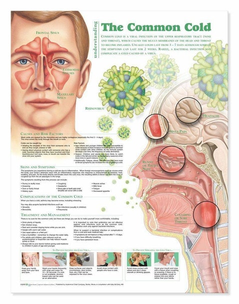Understanding The Common Cold Laminated Anatomical Chart - 2nd Edition