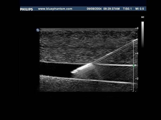 Branched 4 Vessel Ultrasound Training Block Model