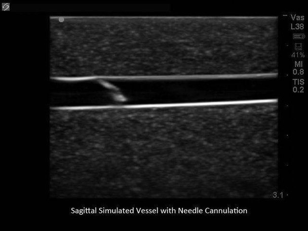 Branched 4 Vessel Ultrasound Training Block Model