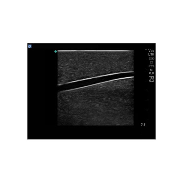 Branched 4 Vessel Ultrasound Training Block Model