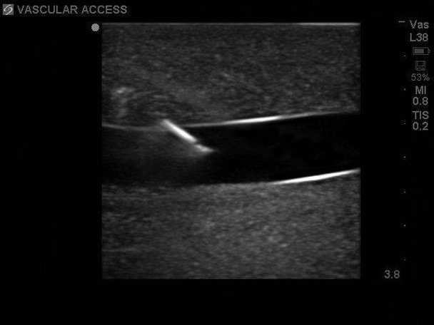 Gen II Ultrasound Central Line Training Model