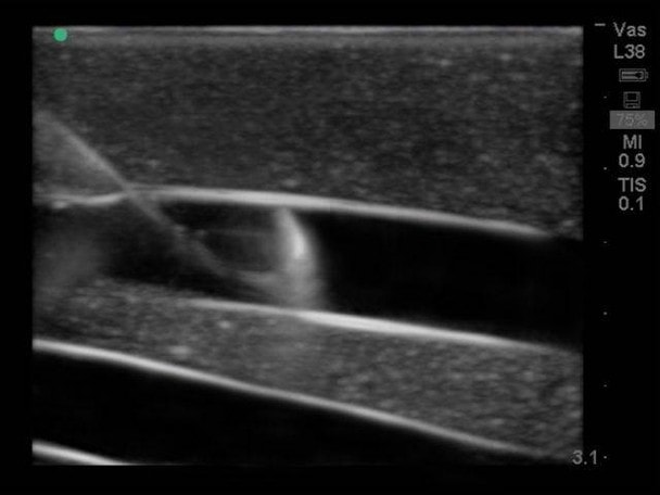 Gen II Ultrasound Central Line Training Model