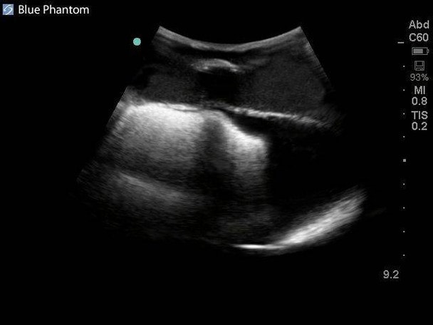 Midscapular Thoracentesis Ultrasound Training Model