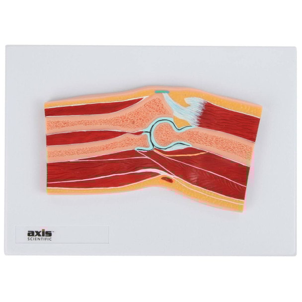 Axis Scientific Elbow Joint Section Anatomy Model