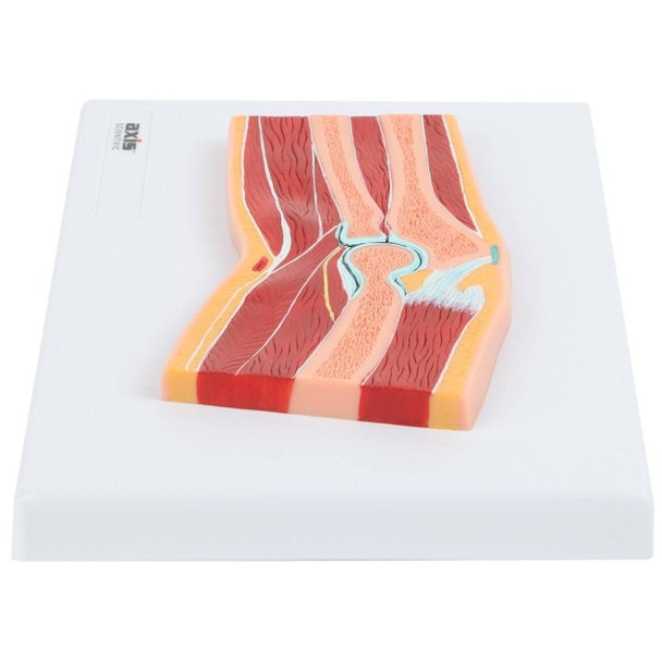 Axis Scientific Elbow Joint Section Anatomy Model