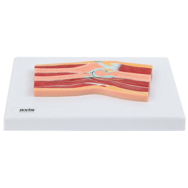 Axis Scientific Elbow Joint Section Anatomy Model