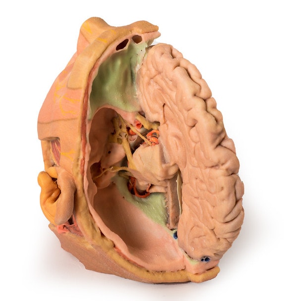 3D Printed Parasagittally - Sectioned Head and Neck