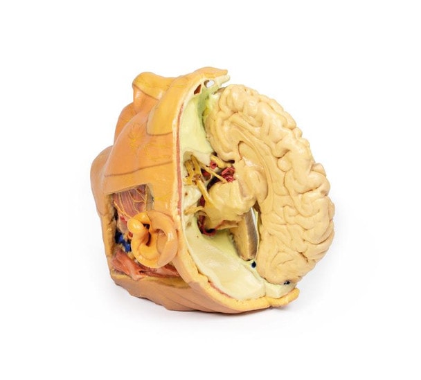 3D printed head and neck. Full view. Exposed muscles and arteries. Side angle.