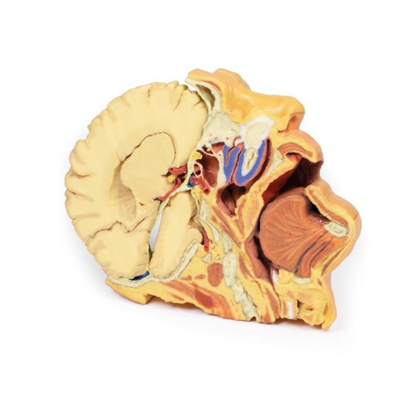 3D printed head and neck. Full view. Exposed muscles and arteries. Side angle.