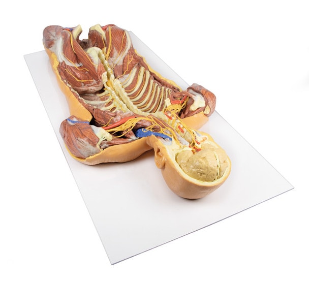 3D Printed Ventral Deep Dissection - Posterior Body Wall