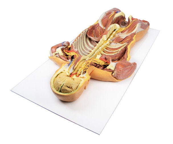 3D Printed Ventral Deep Dissection - Posterior Body Wall