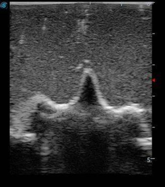 Anatomy Lab Pediatric Lumbar Puncture Ultrasound Training Model