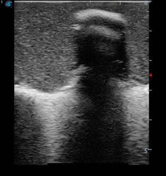 Anatomy Lab Pediatric Lumbar Puncture Ultrasound Training Model