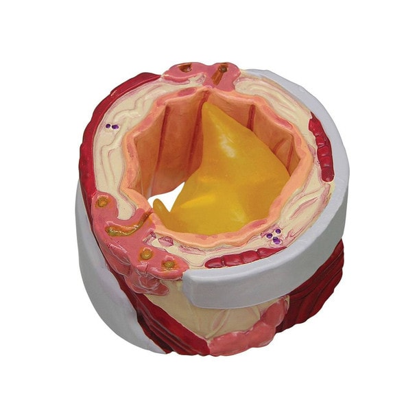 4 Piece Bronchus Anatomy Model