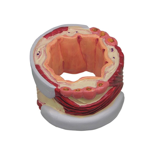 4 Piece Bronchus Anatomy Model