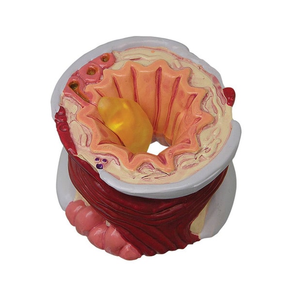 4 Piece Bronchus Anatomy Model