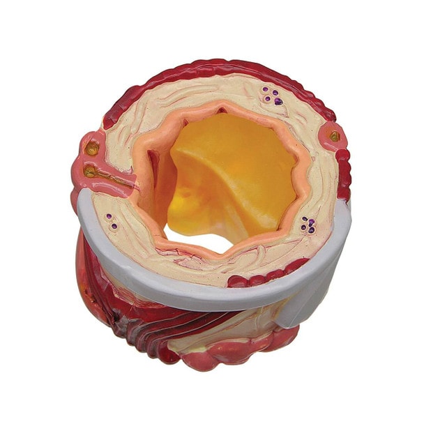 4 Piece Bronchus Anatomy Model
