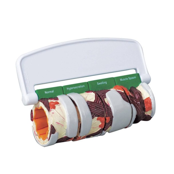 4 Piece Bronchus Anatomy Model