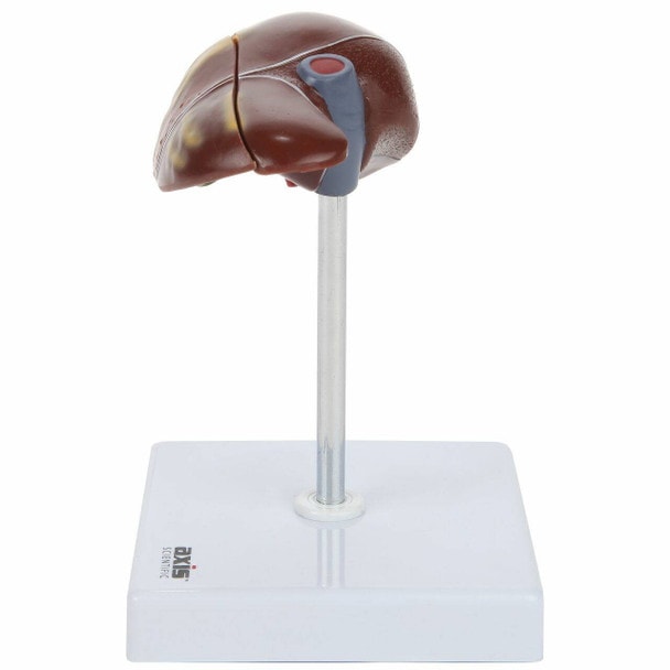 Axis Scientific Liver Anatomy Model