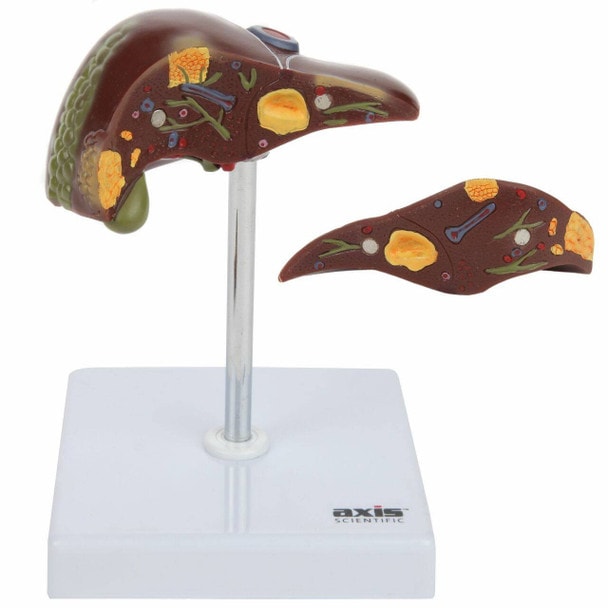 Axis Scientific Liver Anatomy Model