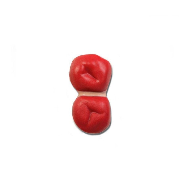 Double Barrel Stoma