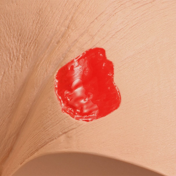 Seymour II Wound Care Model