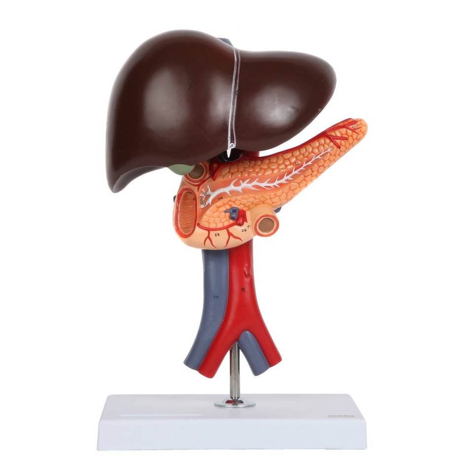 GPI Anatomicals Colon Anatomy Model With Pathologies | Anatomy Warehouse