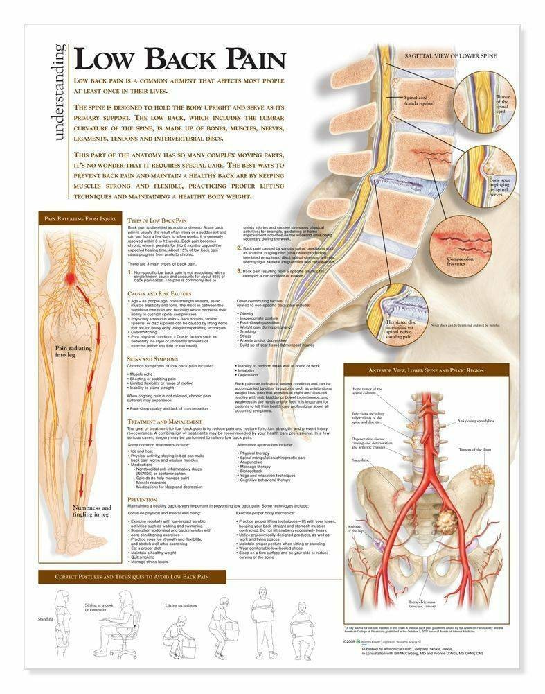 Anatomical Chart Company Understanding Low Back Pain Laminated ...